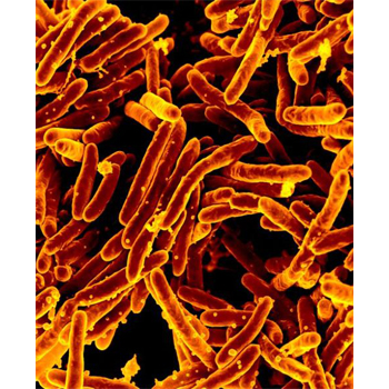 A new test promises better diagnosis of TB in children